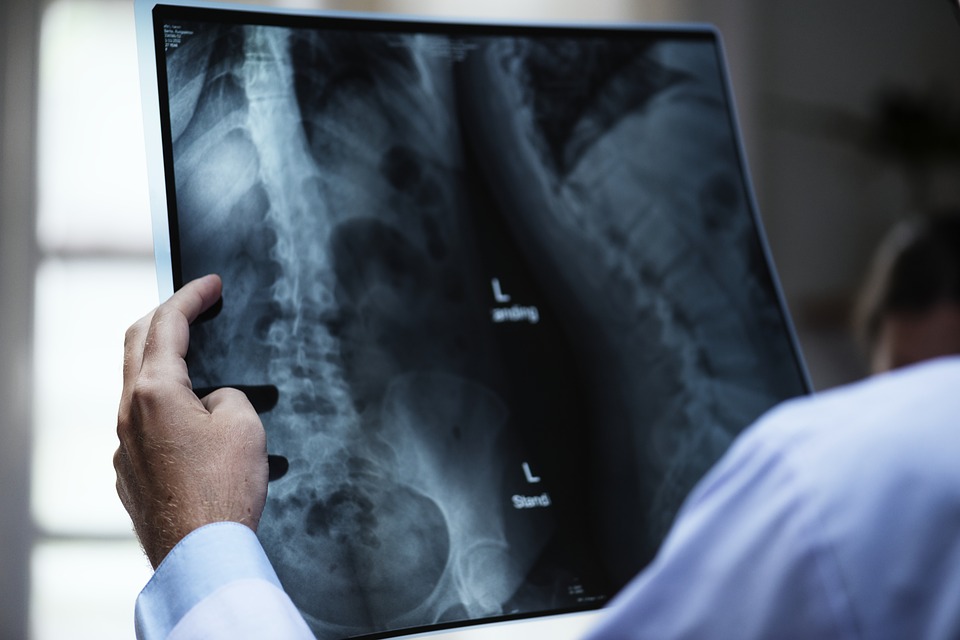 Болница „Бургасмед“ организира безплатни прегледи за заболявания на гръбнака и главния мозък