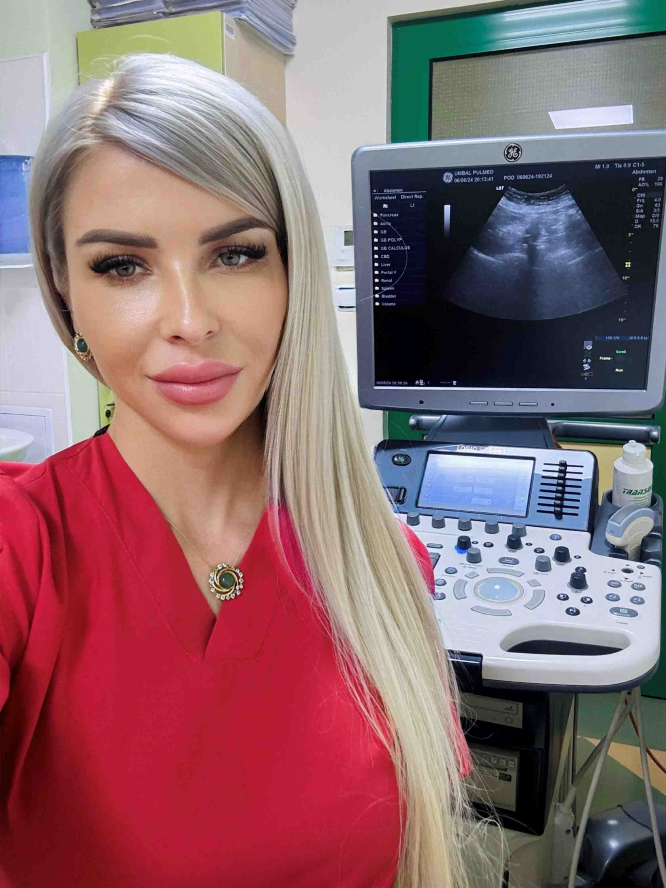 Диетолог съветва как плавно да се върнем във форма след празниците