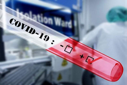 Бургасмед издава резултат от PCR теста за COVID-19 и на английски език
