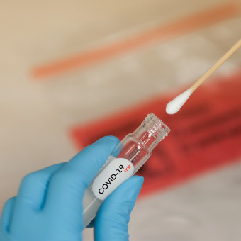 Диагностични тестове за коронавирус с PCR метод