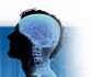 Месец на профилактиката на неврологичните заболявания в МБАЛ БУРГАСМЕД